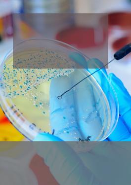 scientist swabbing a petri dish
